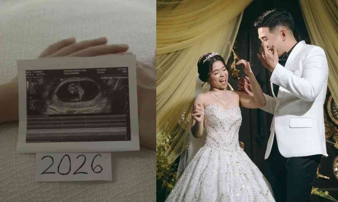 Kiray Celis expecting first child with husband Stephan Estopia
