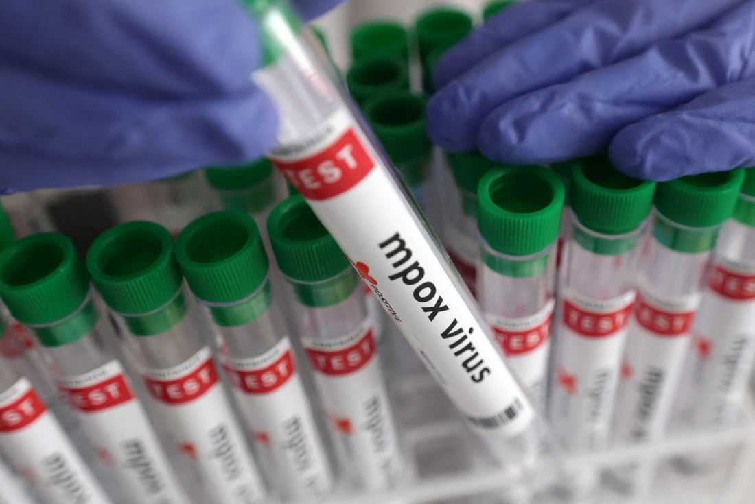 Mpox case confirmed in northeastern Congolese city at center of Ebola outbreak