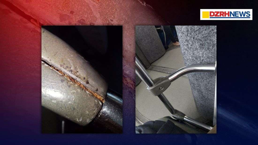 College student shares alleged insect bite on MRT-3; DOTr apologizes