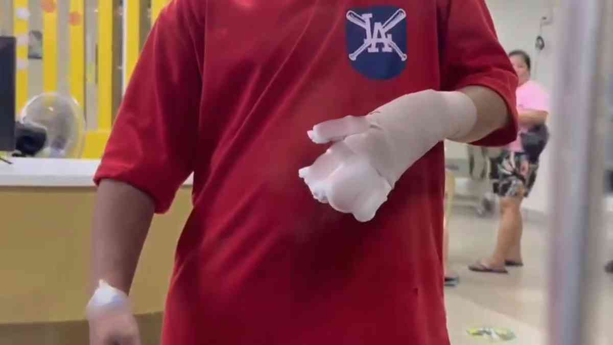 DOH logs 340 cases of firecracker injuries on New Year's day