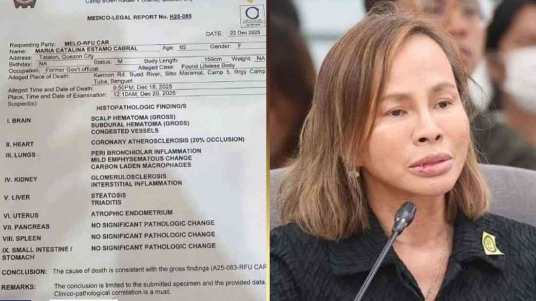 Ex-DPWH Usec. Cabral’s remains test positive for antidepressant – PNP