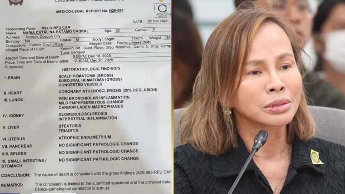 Ex-DPWH Usec. Cabral’s remains test positive for antidepressant – PNP