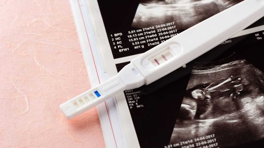 Region 10 and 12 post highest child pregnancy rates – CPD