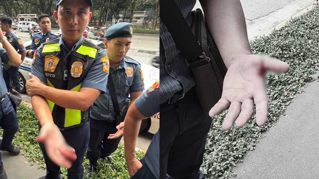 Police officers hurt during rally outside DAR in Quezon City – QCPD