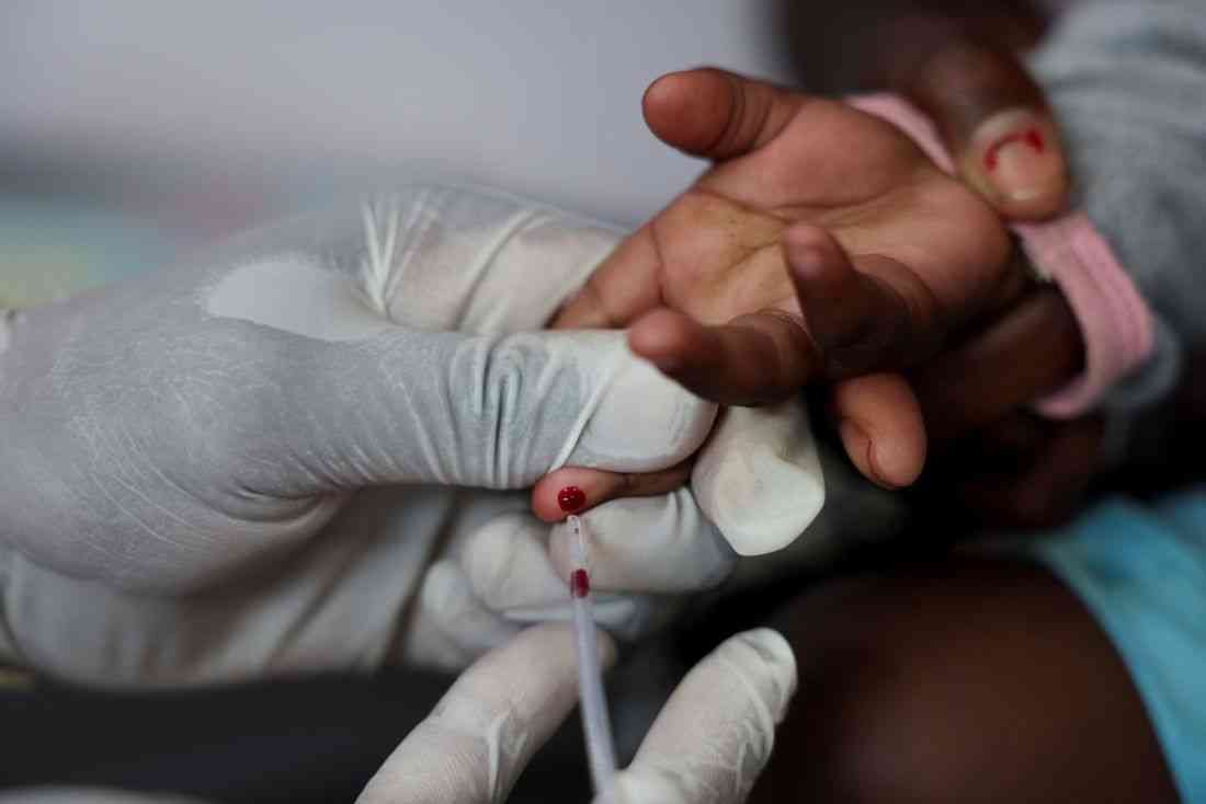 Expert quits US HIV role, rebukes Trump global health approach