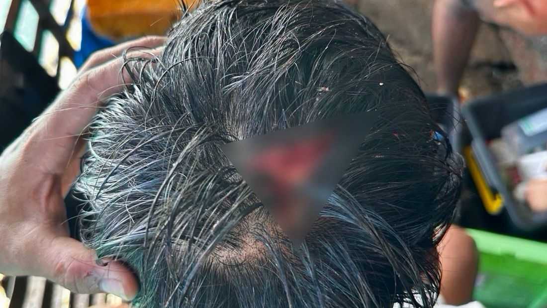 PH Navy personnel injured after being hit by China Coast Guard in Ayungin Shoal — AFP