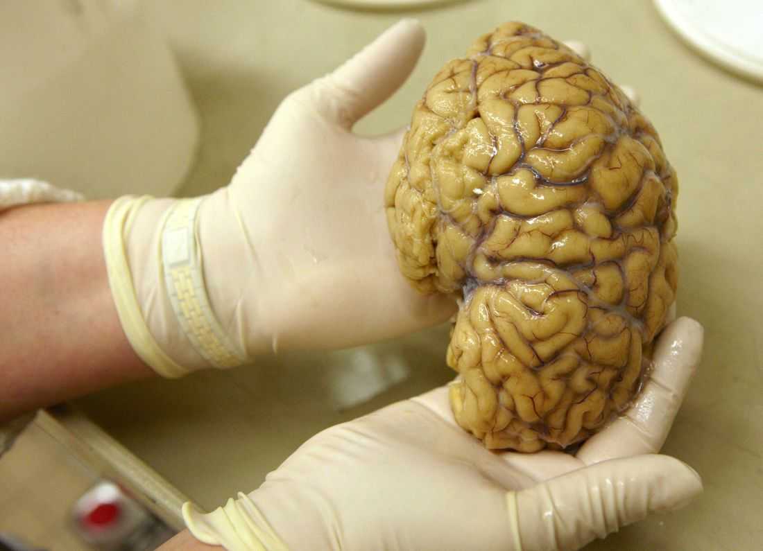 Scientists map gene activity in brain's prefrontal cortex