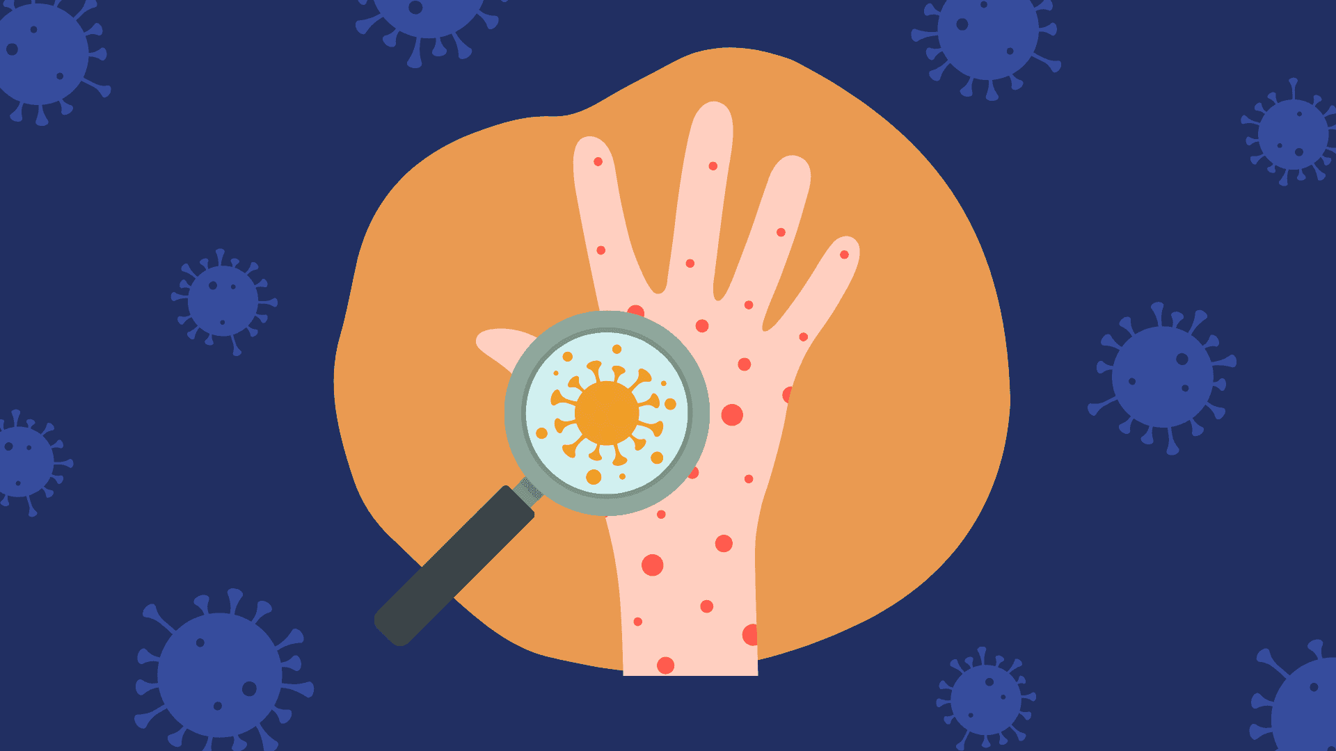 Baguio logs first mpox case