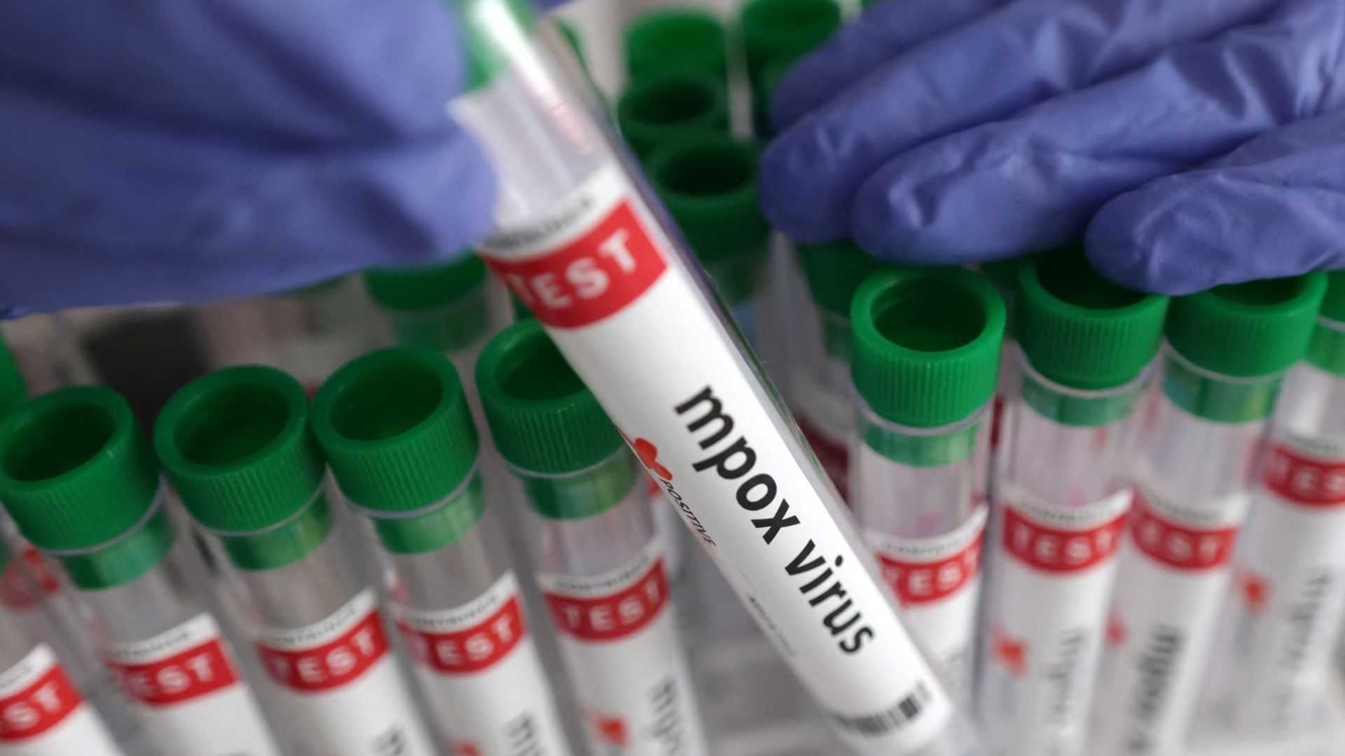 China discovers cluster of new mpox strain