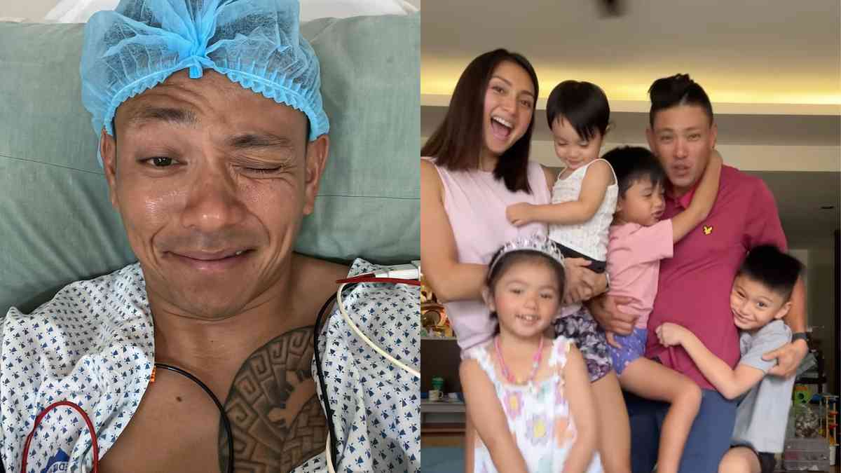 CPD lauds Drew Arellano for getting a vasectomy amidst the prevailing low level of male-centric family planning