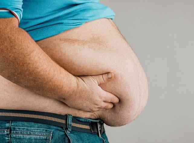 Health expert expresses alarm over rising obesity in PH