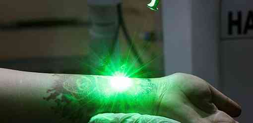 Indonesian Muslims sign up for tattoo removal 'to repent' during Ramadan