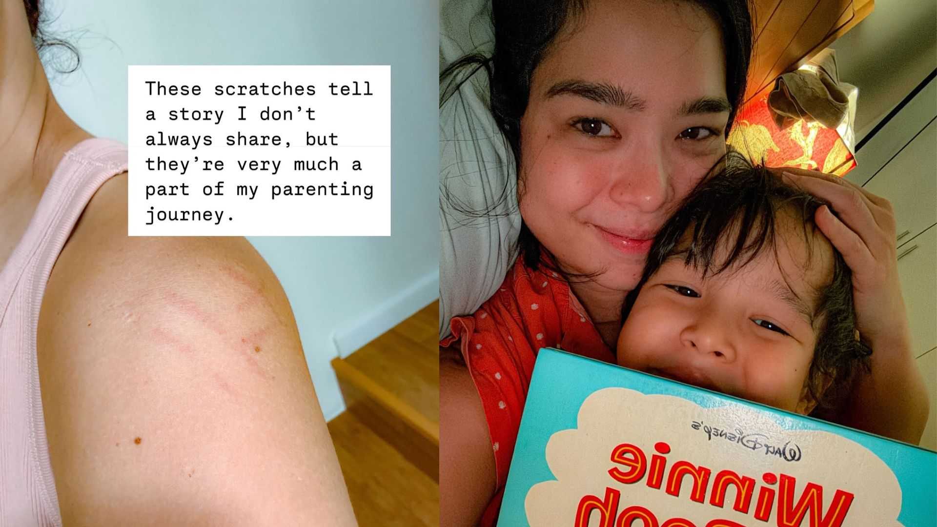 ‘Let’s keep going’: Saab Magalona gets candid about motherhood and raising a child with special needs